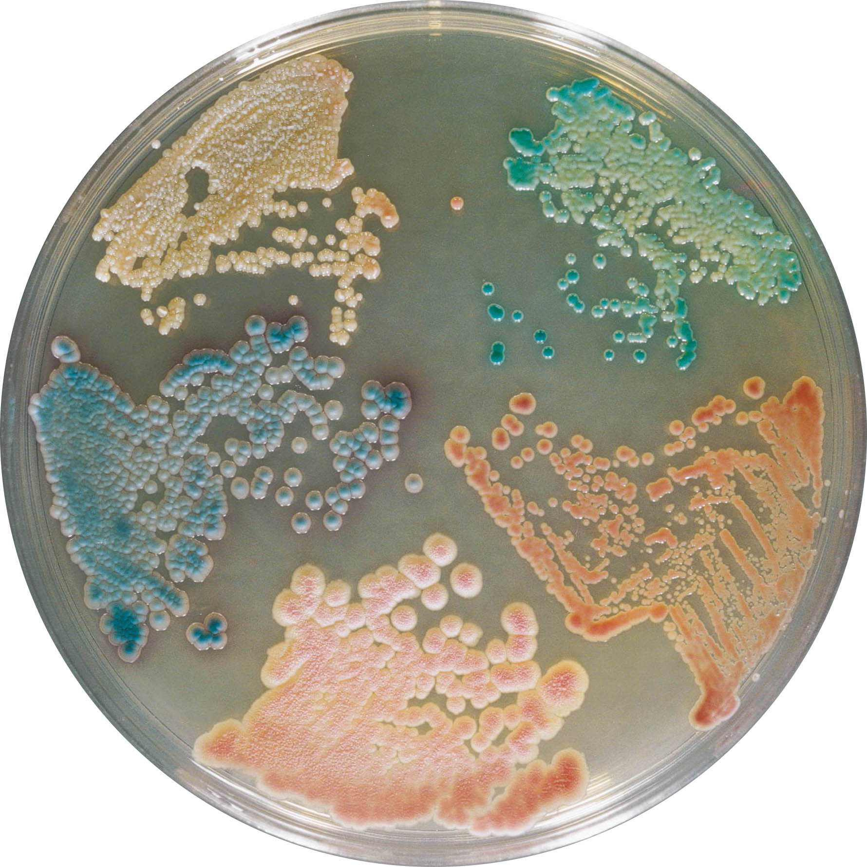 Photo of a sample of different types of bacteria