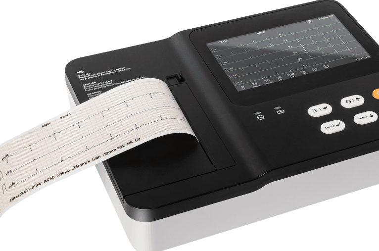 آلة تخطيط القلب البيطرية قادرة على طباعة تقارير تخطيط القلب التفصيلية باستخدام الطابعة المدمجة.