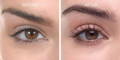 Nulastin Lash Serum Results Before After