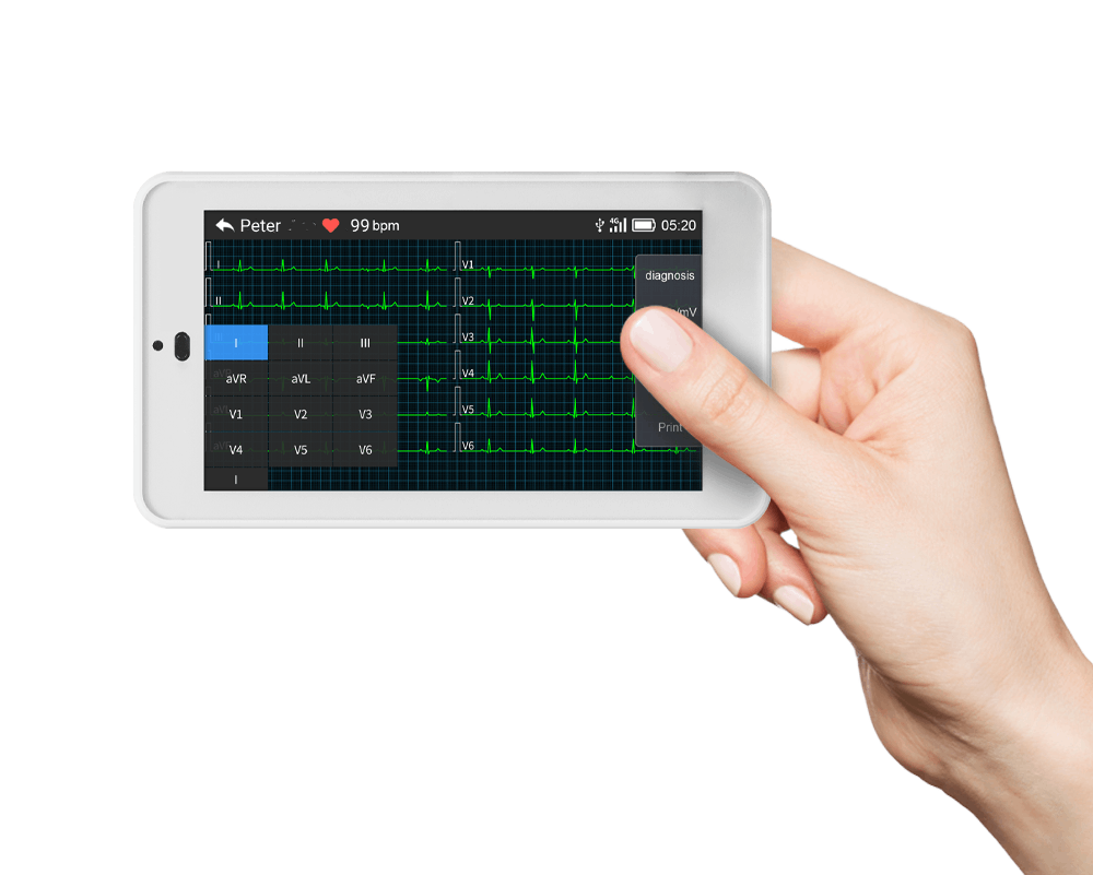 12-Kanal-EKG-Gerät im Taschenformat