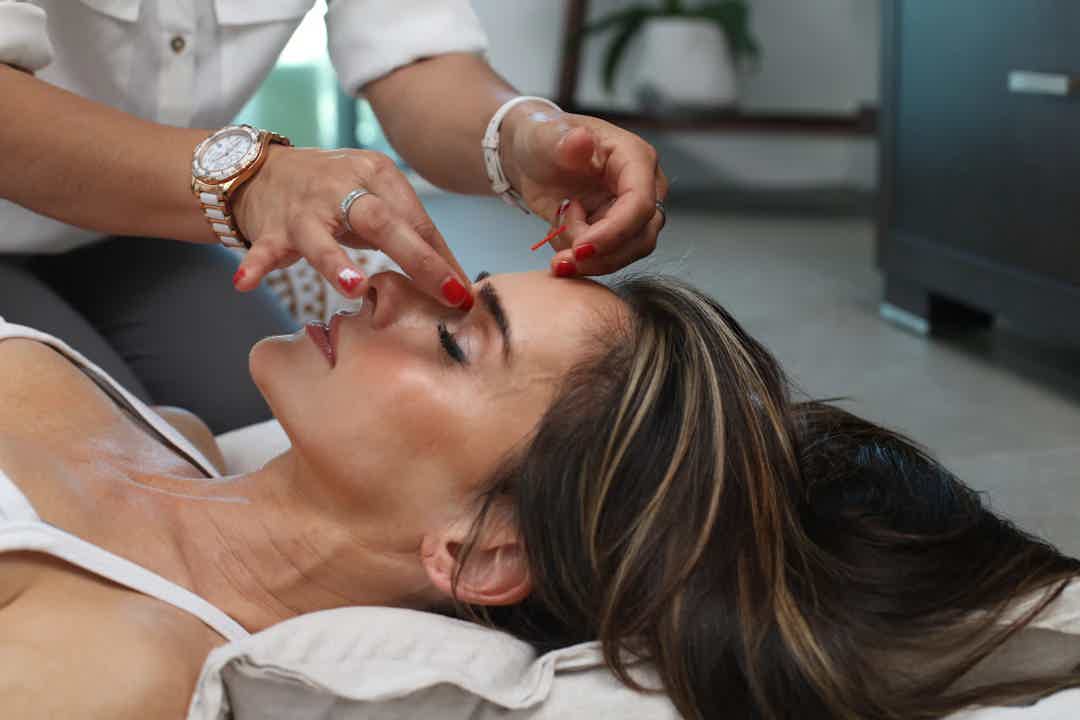 Cosmetic Acupuncture vs. Botox: A Natural Approach to Anti-Aging