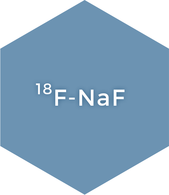 Radio-Flu (¹⁸F-NaF)