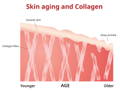 diagram of the skin and how collagen fibers naturally break down as we age, causing deep wrinkles with age