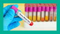 Test Tubes that say Heavy Metal Test