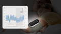 ABPM は血圧を 24 時間 7 日追跡し、XNUMX 日の血圧変動を示します。