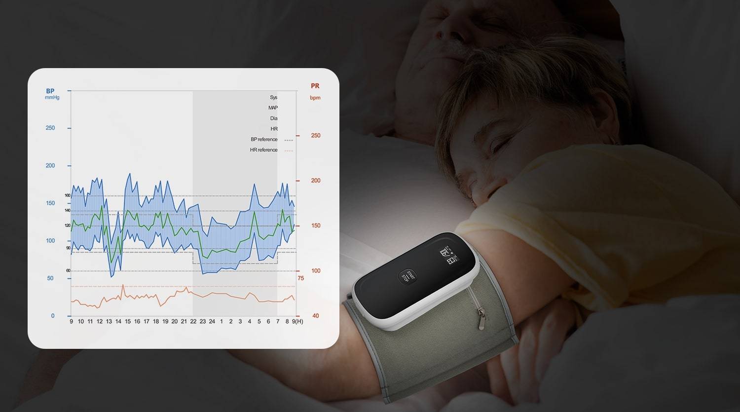 ABPM は血圧を 24 時間 7 日追跡し、XNUMX 日の血圧変動を示します。