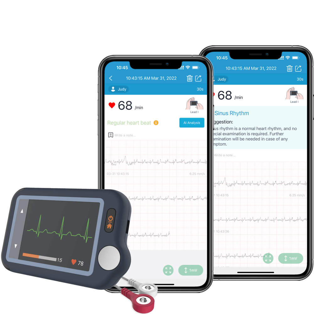 get ECG results by AI analysis