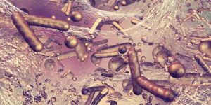SIBO Biofilm Explained: Symptoms, Causes, and a Treatment Protocol