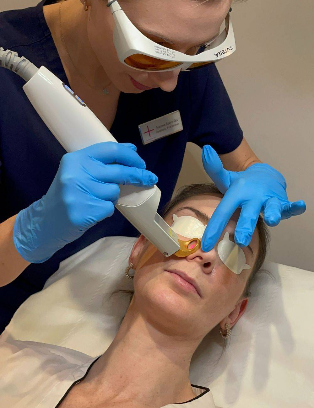 Excel V Laser Treatment for Redness, at Medicetics London