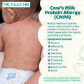 Cow's Milk Protein Allergy (CMPA) | The Milky Box