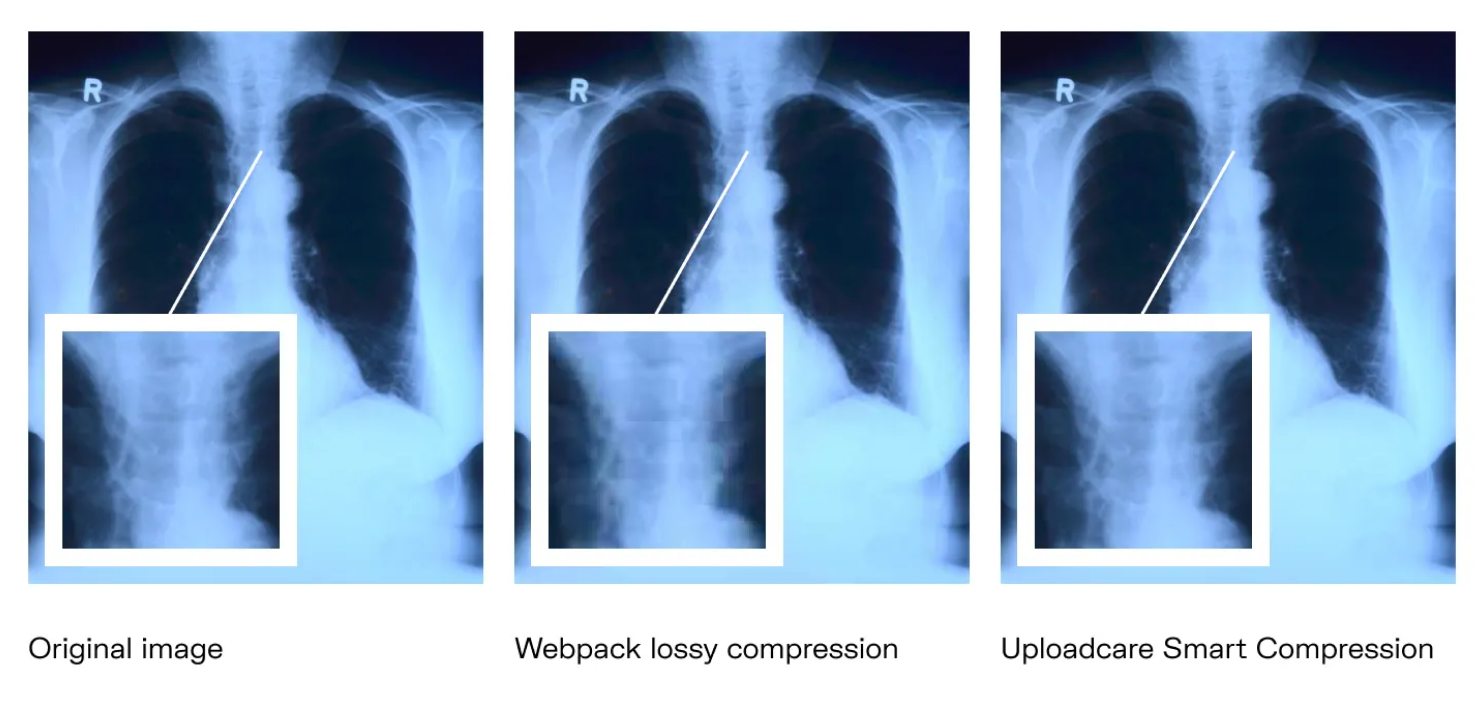 A comparison of Uploadcare Smart Compression with other methods of compression
