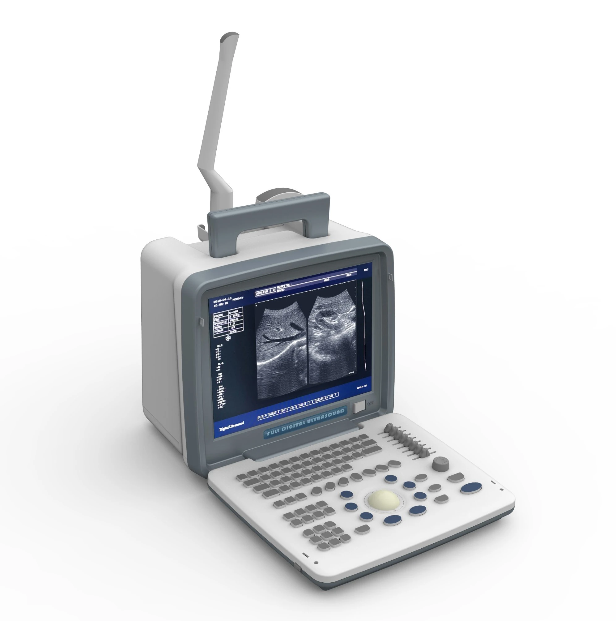 Ultrasound Portable B/w Xf 300 , Probes: Linear + Convex