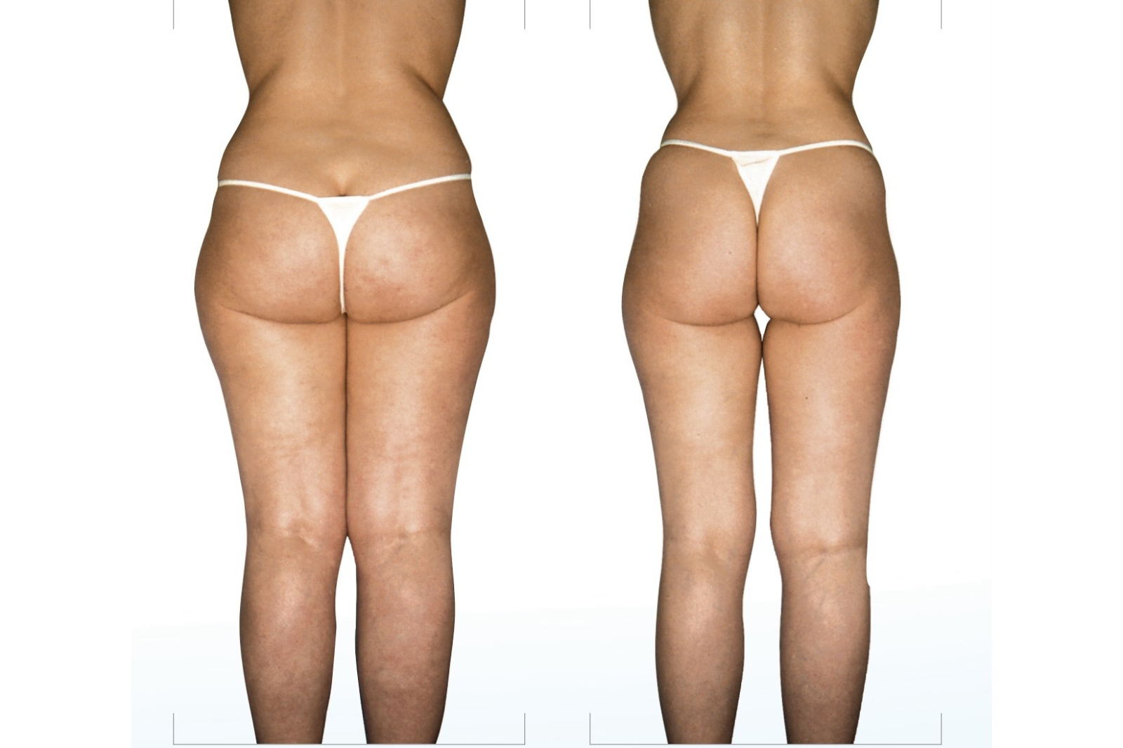 Rejuvenate Wellness Centre - Voucher - Image 5