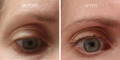 Nulastin Lash Serum Results Before After