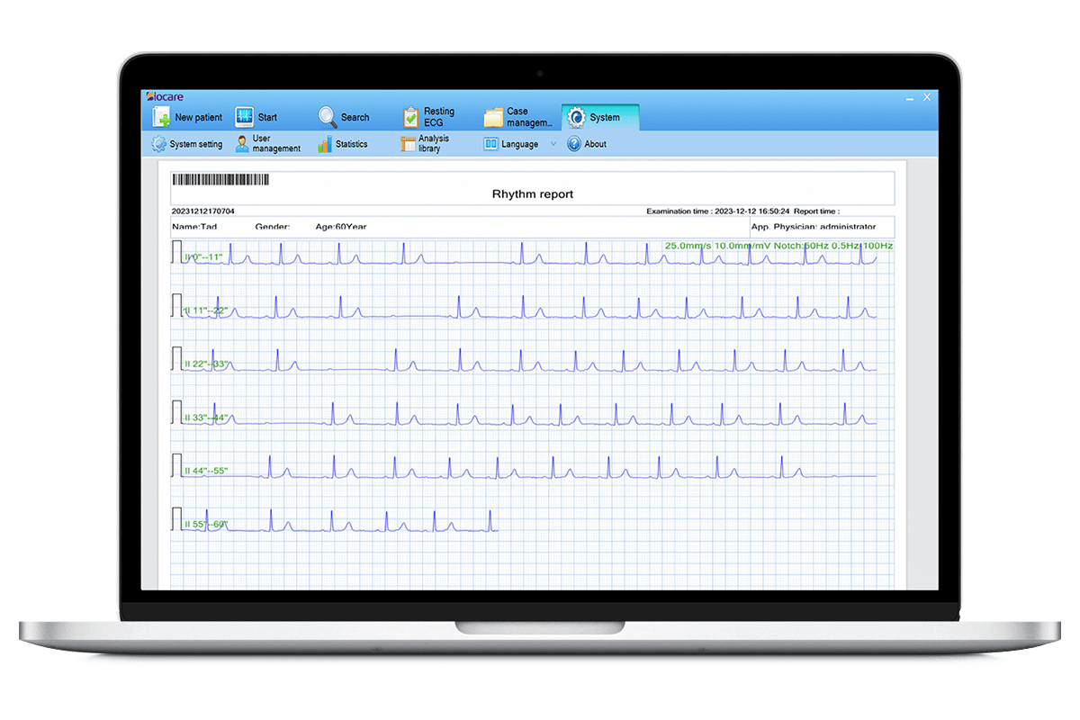 ECG PC software for the 12-lead 12-channel EKG machine
