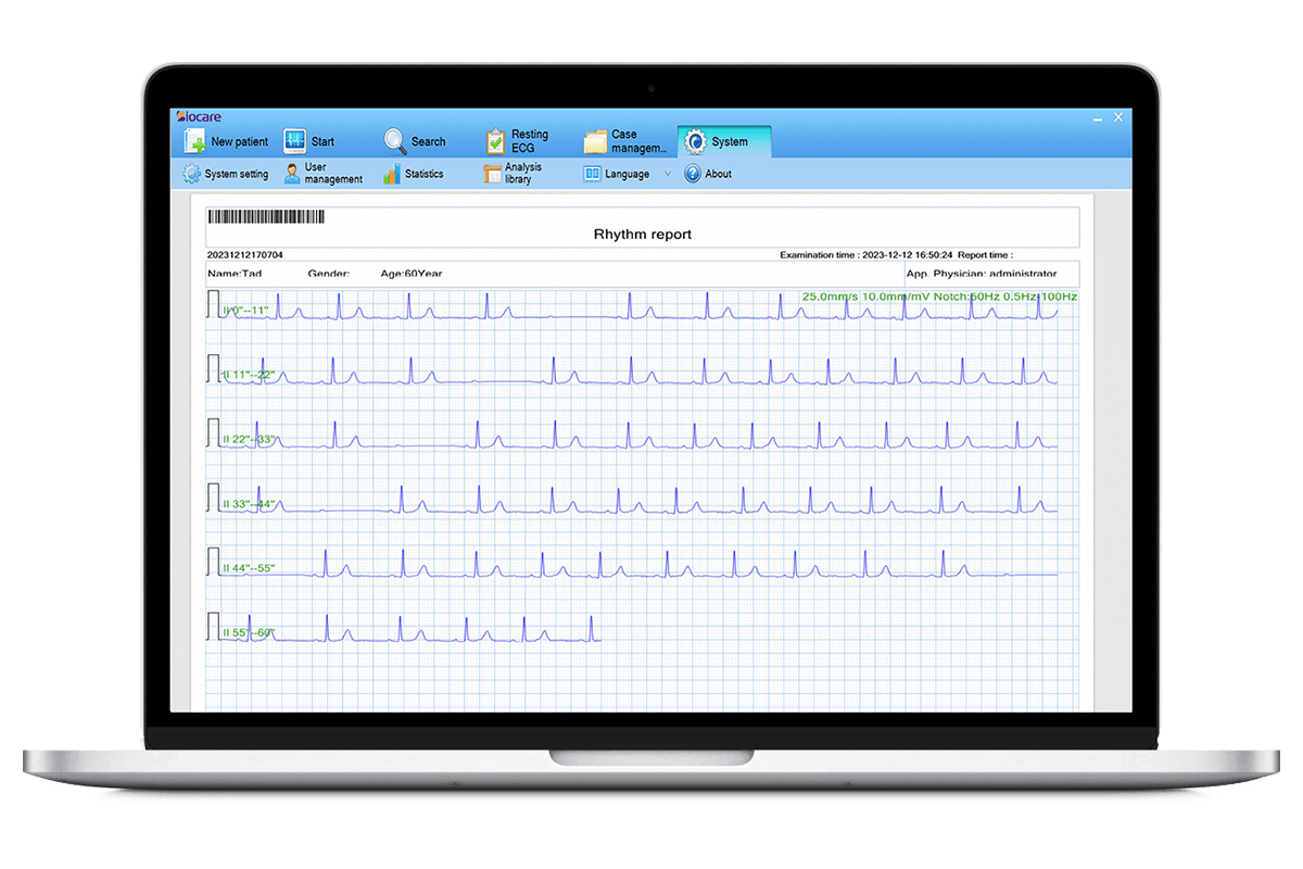 Sistema de gestión de datos de ECG.