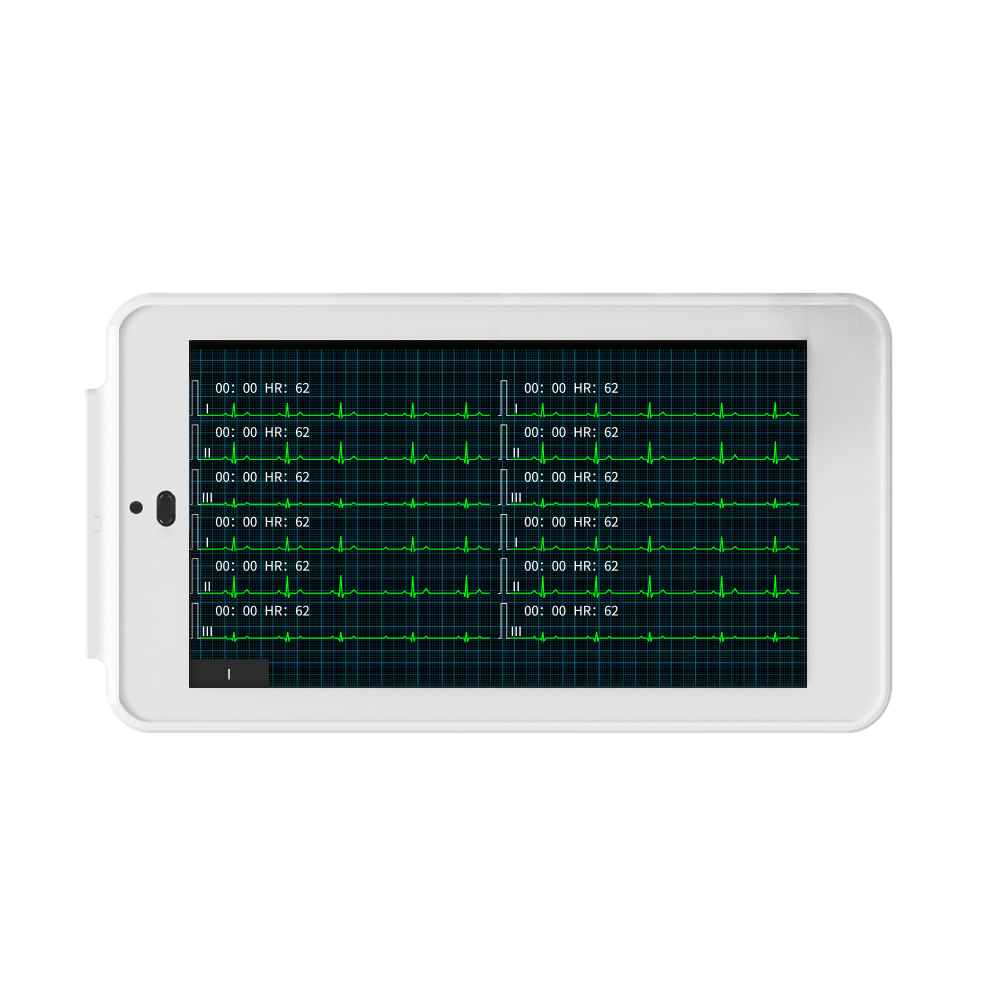 Mini électrocardiographe 12 dérivations