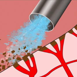 Illustration of vigorous washing removing coagulum