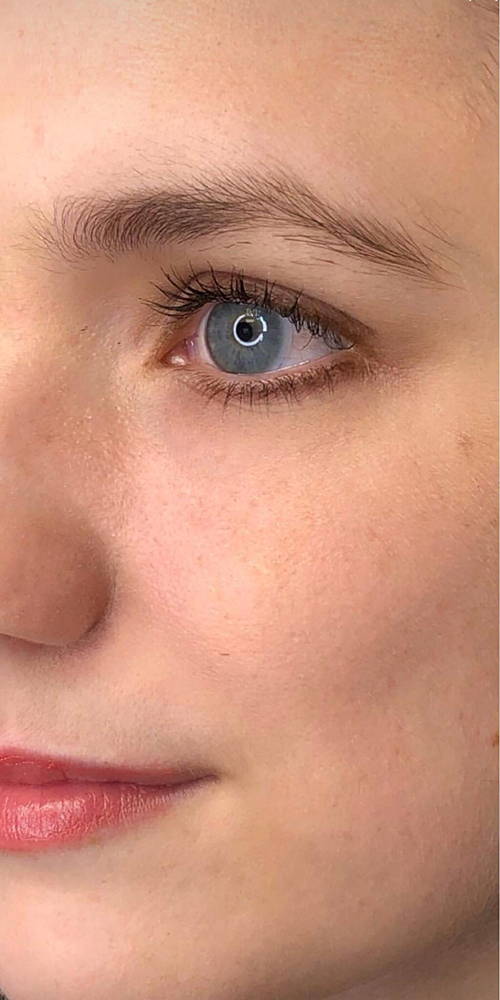 WunderHaut Anti-Aging Genius™ mit Radiofrequenz, LED Licht- und Mesotherapie, EMS und Elektroporation