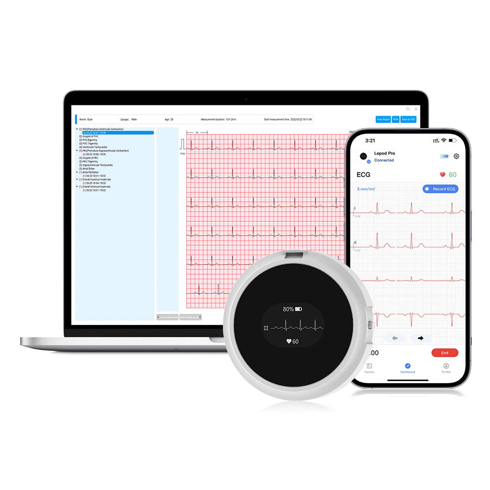 wellue 12-lead holter monitor with ai analysis