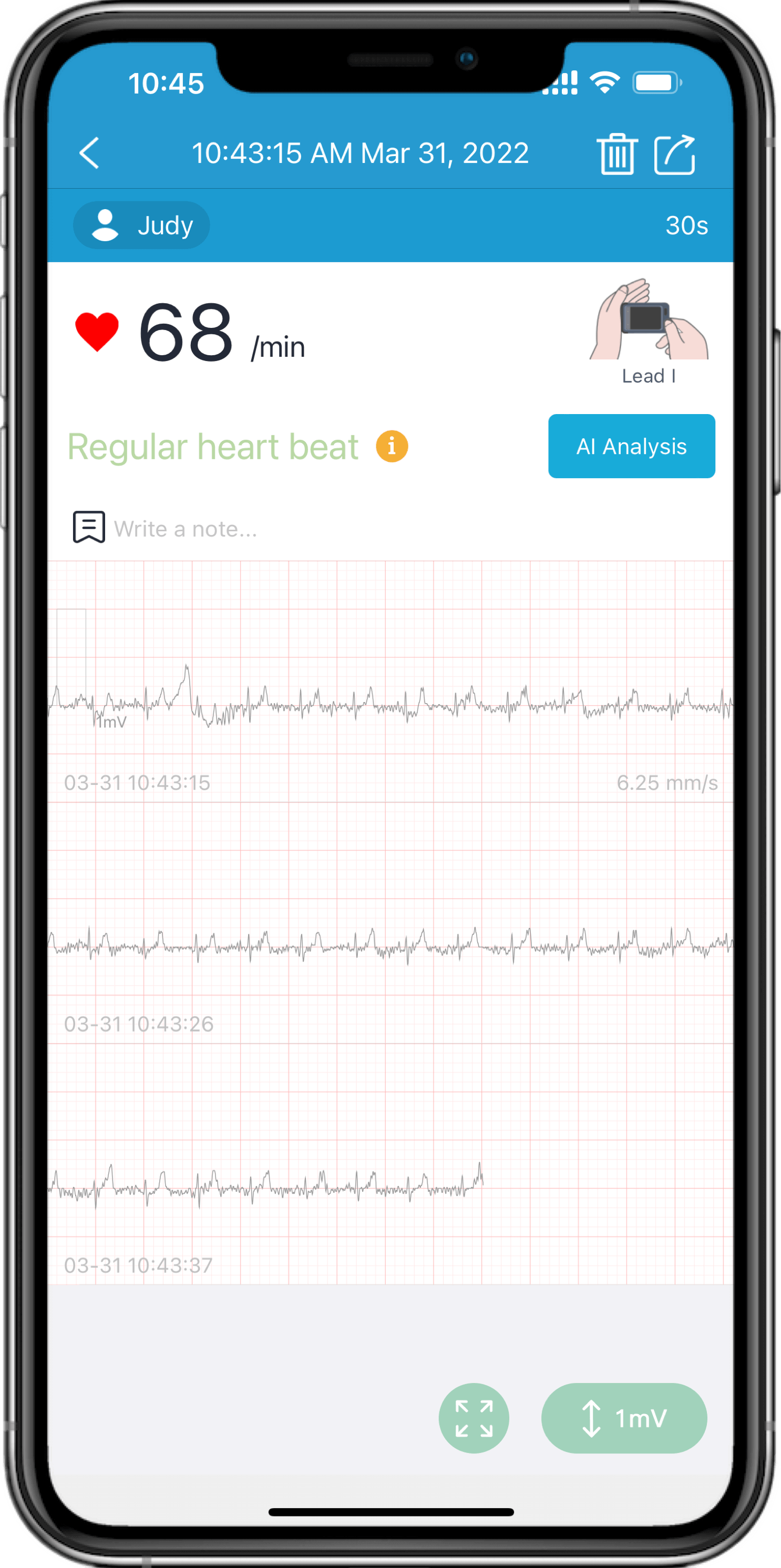 التقاط أحداث تخطيط القلب عبر التطبيق