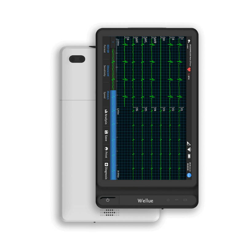 ECG portatile a 12 derivazioni di grado ospedaliero Wellue con design tablet.