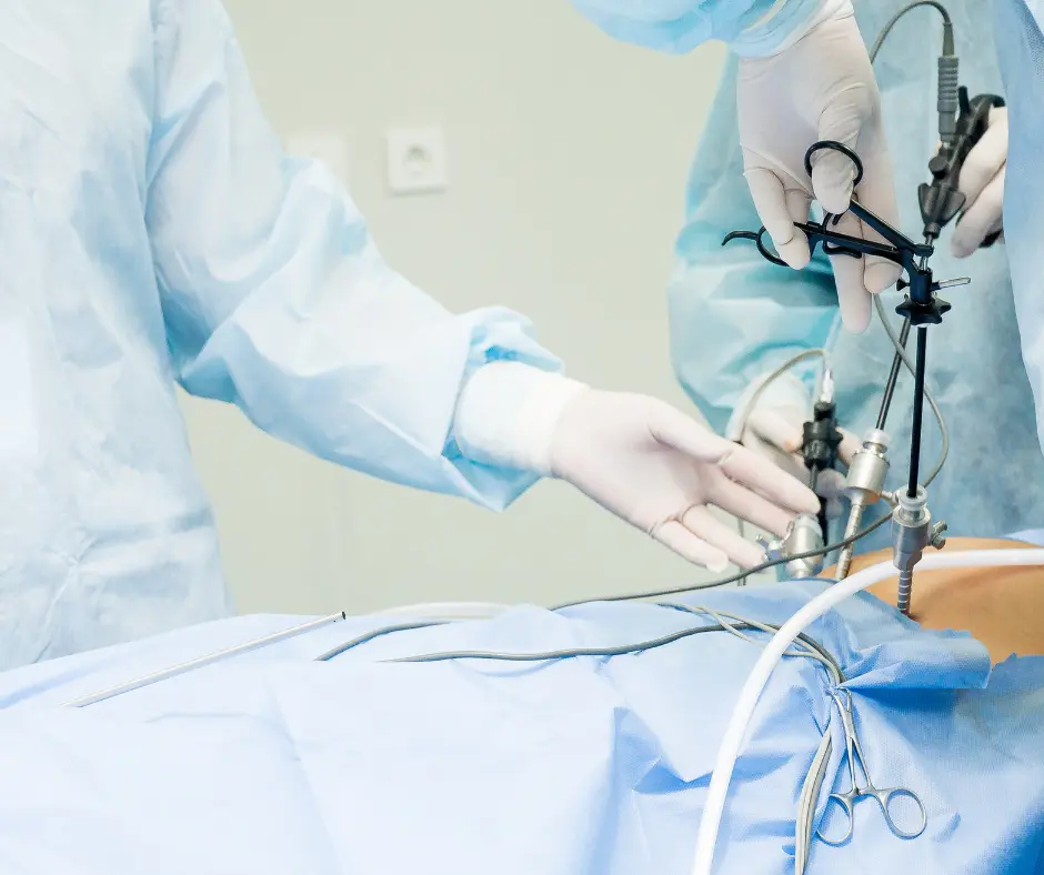 Laparoscopic Surgery General Surgery in dubai