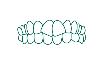 Generally Straighter Teeth