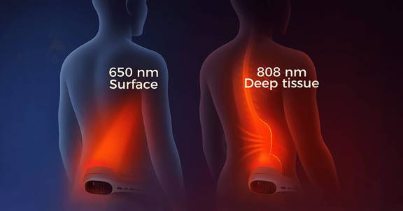 Cold laser therapy wavelengths 650nm and 808nm for sciatica and arthritis deep pain relief