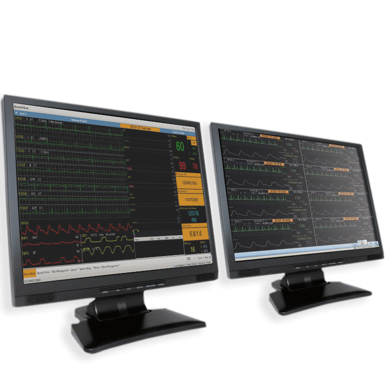 Central monitoring software