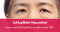 schlupflider hausmittel