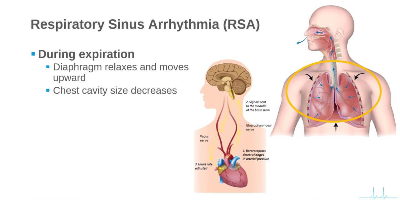 respiratory sinus arrhythmia, RSA, coronary heart disease, angina pectoris, rheumatic heart disease, valvular disease, heart failure