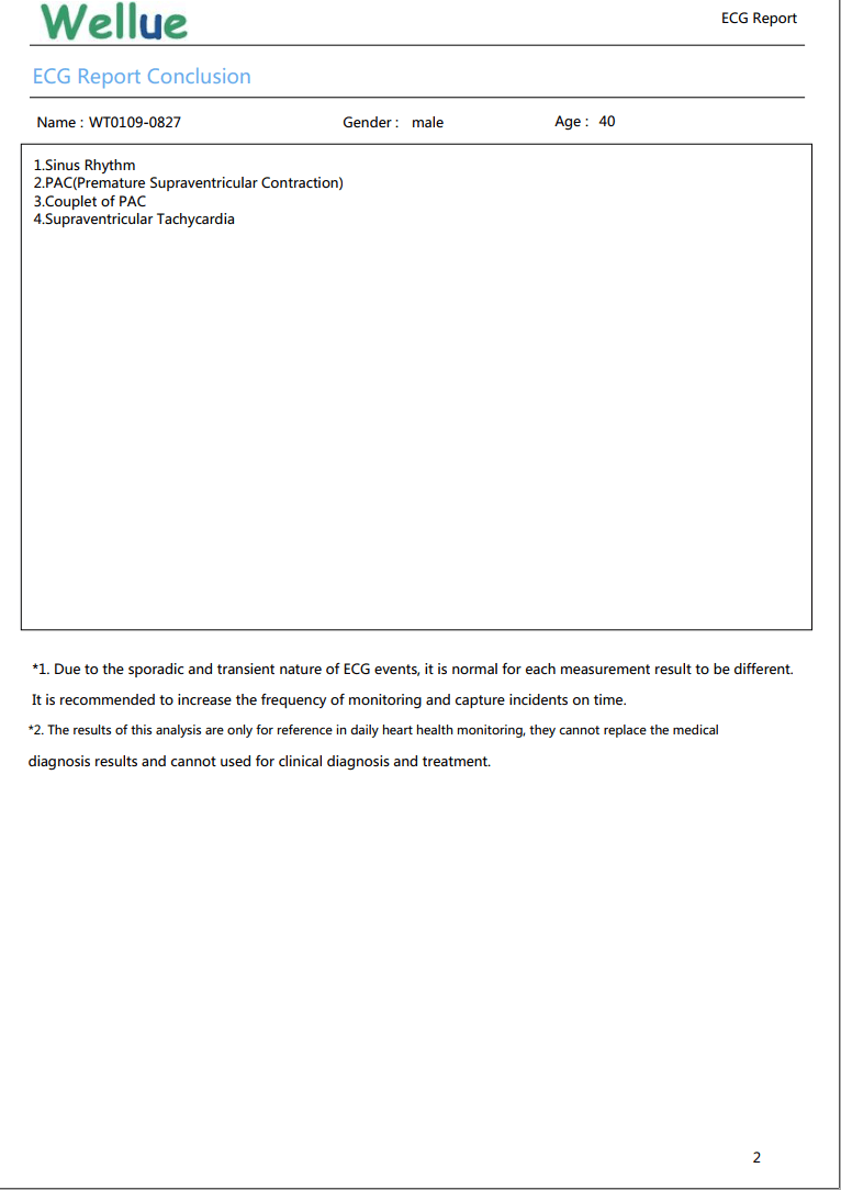 ECG detailed report