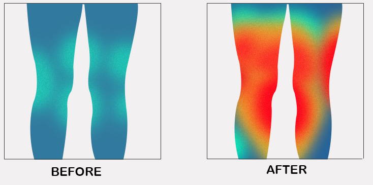 anteromedial knee pain ,  what causes pain in the back of the knee ,  sciatica symptoms ,  sharp stabbing pain in knee comes and goes ,  pain on outside of knee when bending and straightening ,  va disability calculator ,  what is gout in the knee ,  my knee hurts when i bend it and straighten it ,  top of knee pain when bending ,  cbd for knee pain ,  pain behind knee cap ,  glucosamine for knee pain ,  bakers cyst ,  back of knee pain when bending ,  patellar tendonitis treatment ,  how to get rid of knee pain fast ,  hamstring pain behind knee ,  jumpers knee ,  meniscus tear symptoms ,  chondromalacia patella ,  best cbd for knee pain ,  can sciatica cause knee pain ,  patellar tendon ,  types of knee pain ,  mcl pain location ,  knee pain exercises ,  knee pain when bending ,  how to get rid of knee pain fast ,  knee pain treatment at home ,  knee pain in ladies ,  types of knee pain ,  knee pain reasons ,  knee pain symptom checker ,  knee pain when bending ,  knee pain exercises ,  knee pain treatment at home ,  knee pain in ladies ,  knee pain reasons ,  knee pain causes in young adults ,  back of knee pain ,  side of knee pain ,  knee pain when bending ,  knee pain relief ,  knee pain exercises ,  exercises for knee pain ,  knee cap pain ,  inner knee pain ,  knee stretches for pain ,  knee pain when squatting ,  stretches for knee pain ,  knee joint pain ,  what is the best painkiller for knee pain ,  how to get rid of knee pain fast ,  lateral knee pain ,  knee pain after running ,  knee pain treatment at home ,  knee pain on inside of knee ,  back of knee pain when straightening leg ,  knee pain in ladies ,  knee pain symptom checker ,  knee cap for knee pain ,  best heating pad for neck and shoulder pain ,  exercises for neck and shoulder pain ,  rheumatoid arthritis ,  shoulder brace ,  shoulder pain from lifting ,  kt tape for shoulder pain ,  shoulder impingement treatment ,  shoulder pain that radiates down arm ,  stabbing pain under left shoulder blade ,  frozen shoulder symptoms ,  right shoulder pain heart attack ,  stabbing pain under right shoulder blade ,  posterior shoulder pain ,  shoulder pain when raising arm ,  signs of heart attack ,  fibromyalgia ,  herniated disc ,  right shoulder pain ,  shoulder pain exercises ,  shoulder pain when lifting arm ,  right shoulder pain in women ,  shoulder pain treatment ,  causes of shoulder pain in female ,  shoulder pain left side ,  shoulder pain reasons ,  right shoulder pain ,  shoulder pain when lifting arm ,  shoulder pain treatment ,  causes of shoulder pain in female ,  shoulder pain left side ,  shoulder pain reasons ,  shoulder blade pain ,  left shoulder pain ,  shoulder and neck pain ,  neck and shoulder pain ,  shoulder pain diagnosis chart ,  right shoulder pain ,  front shoulder pain ,  shoulder back pain ,  shoulder pain relief ,  shoulder pain exercises ,  back shoulder pain ,  shoulder joint pain ,  shoulder pain from sleeping ,  shoulder blade pain left side ,  shoulder and neck pain on right side ,  shoulder and neck pain on left side ,  shoulder and left arm pain ,  shoulder pain when lifting arm ,  neck and shoulder pain on left side ,  neck and shoulder pain on right side ,  left arm and shoulder pain ,  shoulder blade pain right side ,  shoulder blade pain left side woman ,  causes of shoulder pain in female ,  shoulder pain left side ,  shoulder pain relief exercises ,  shoulder pain cancer ,  shoulder pain after workout ,  shoulder pain treatment at home ,  sudden shoulder pain without injury , 