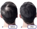 Hair improvement of a male user of our best vitamins for hair growth