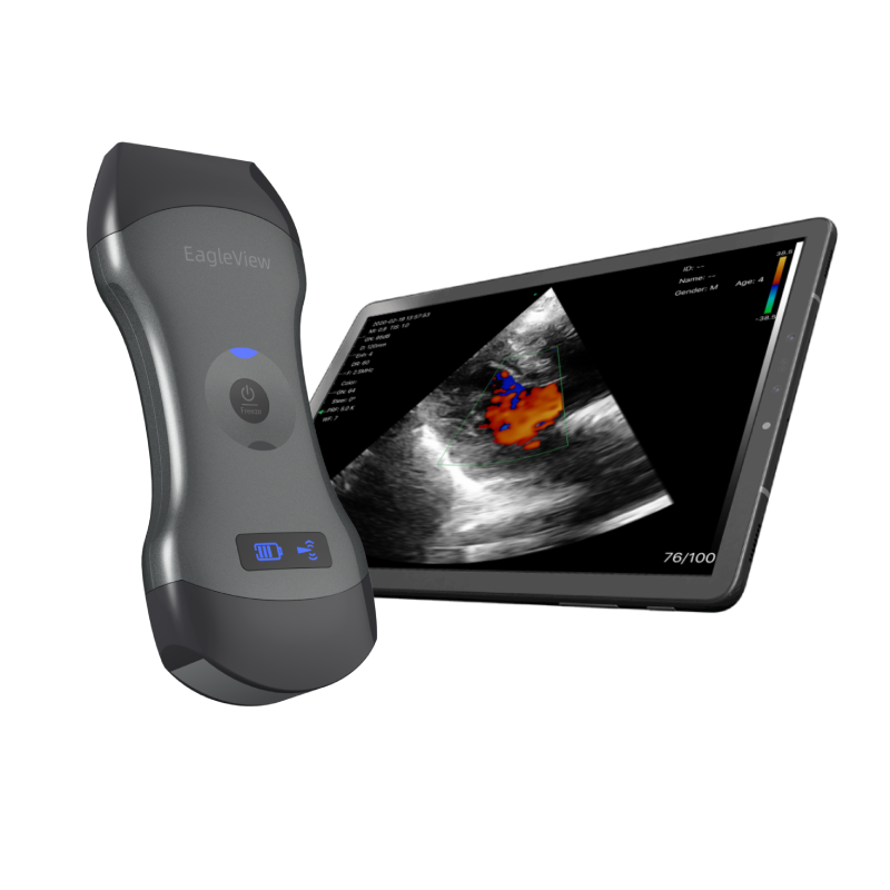Multipurpose handheld wireless ultrasound scanner with app shows image.