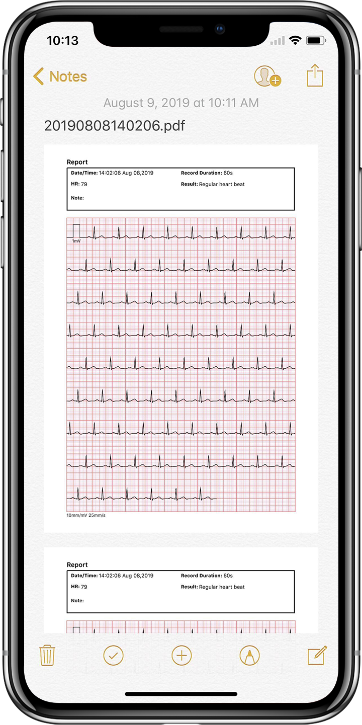 app monitor ekg wellue, app kardiamobile, app monitor del ritmo cardiaco,