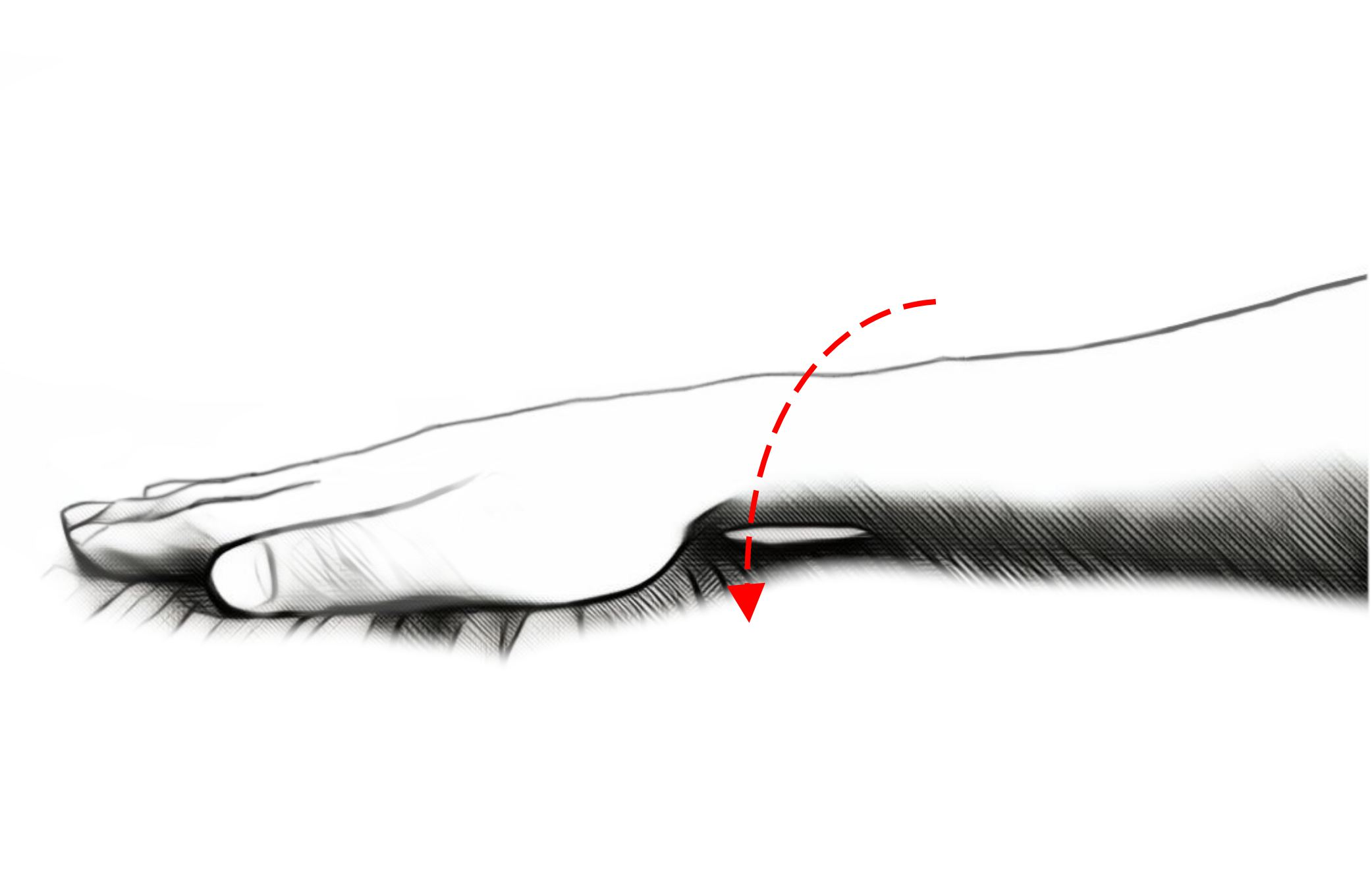 forearm pronation