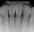 Port operative xray