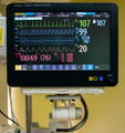 Checkme™ Doctor Vital Signs Monitor