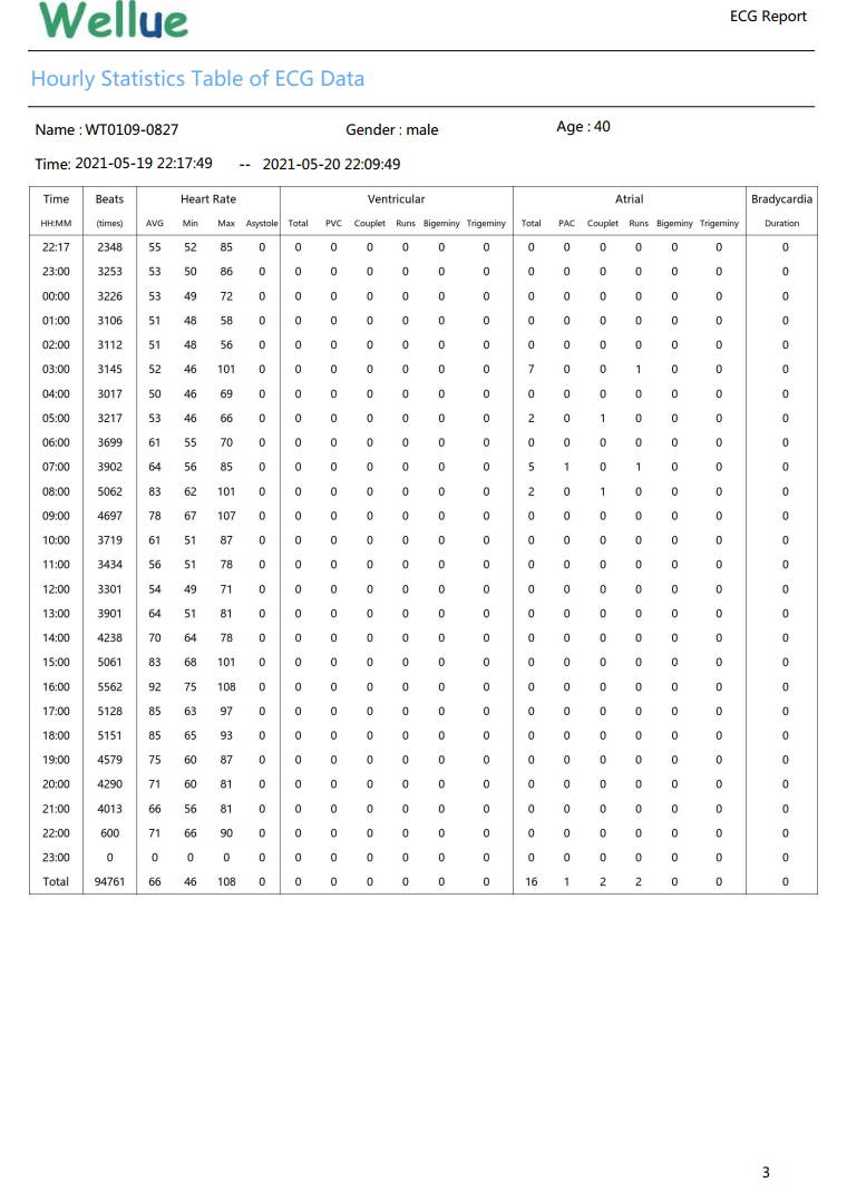 Informe de ECG Wellue