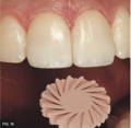ASAP polishing tooth