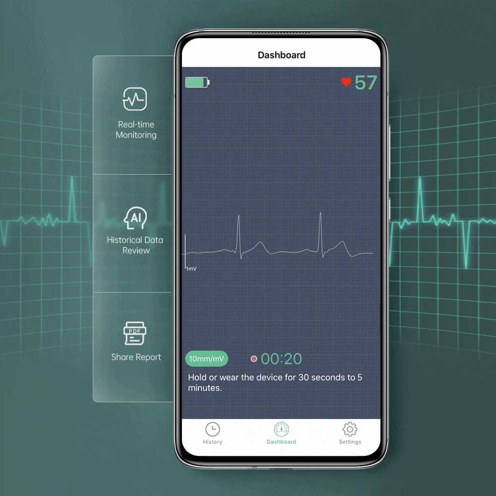 OLED 화면이 있는 휴대용 EKG 모니터용 APP
