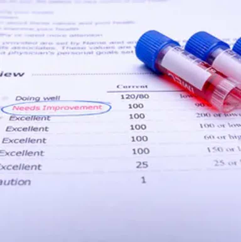 Performance review results sheet with a circled “Needs Improvement” and two blue markers on the page.