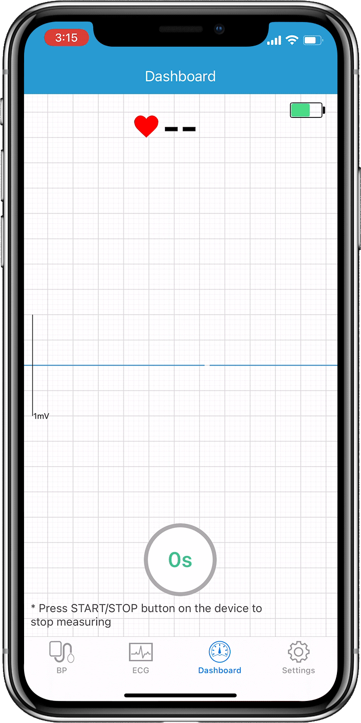 forme d'onda ecg in tempo reale visualizzate sull'app del telefono