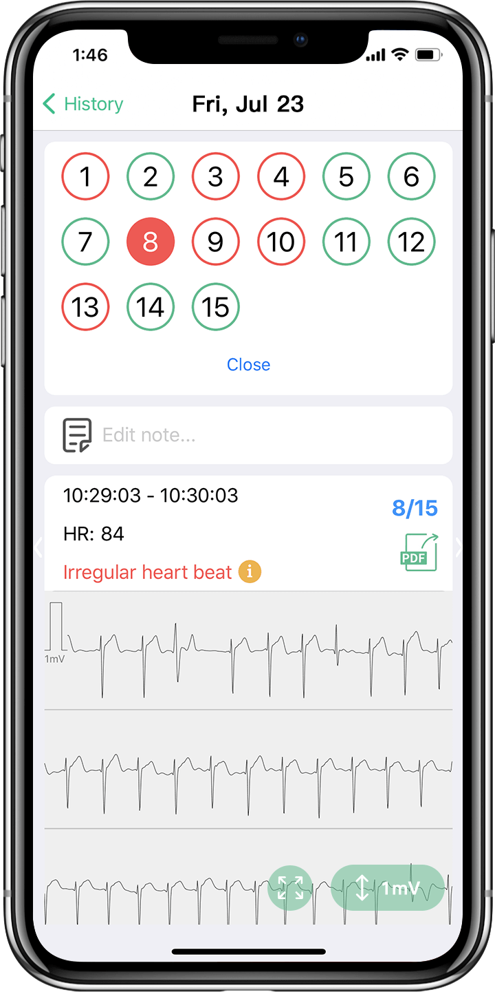 informe wellue ecg/ekg para detectar arritmias