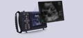 Wellue 12-lead pocket ECG machine allows users to manage patient cases on the screen