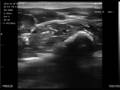 Ultraschallbild des Handgelenks