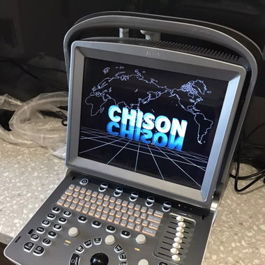 Chison Eco 5 Mobiles Ultraschall Portable 