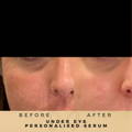 Before & After Pictures Dr Sknn Wilmslow Cheshire